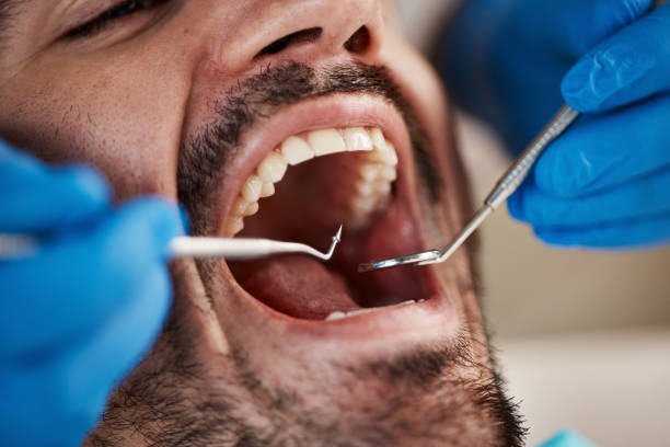 Best Orthodontic Emergency Dentist in Dover, OH